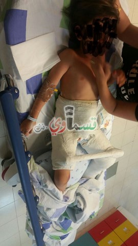 إصابة طفل (5 سنوات) دهسًا في ساحة العين- مجد الكروم بعد ان نزل من سيارة المخيم الصيفي 